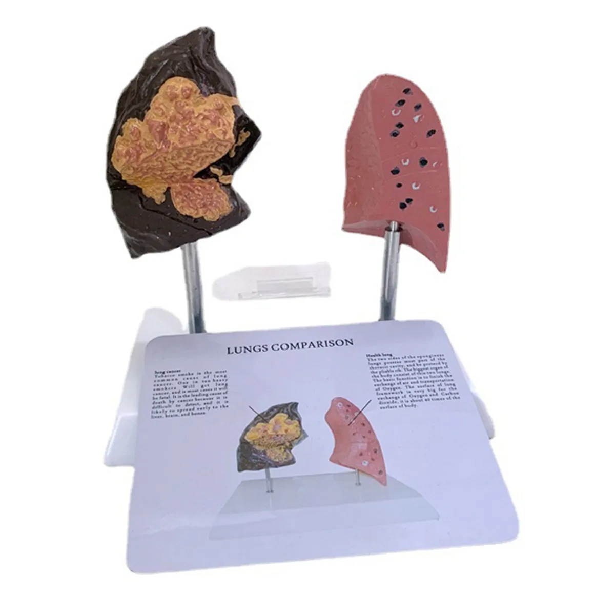 Smoker's Lung Model Healthy Lung Model Lung Anatomy Compatible with None