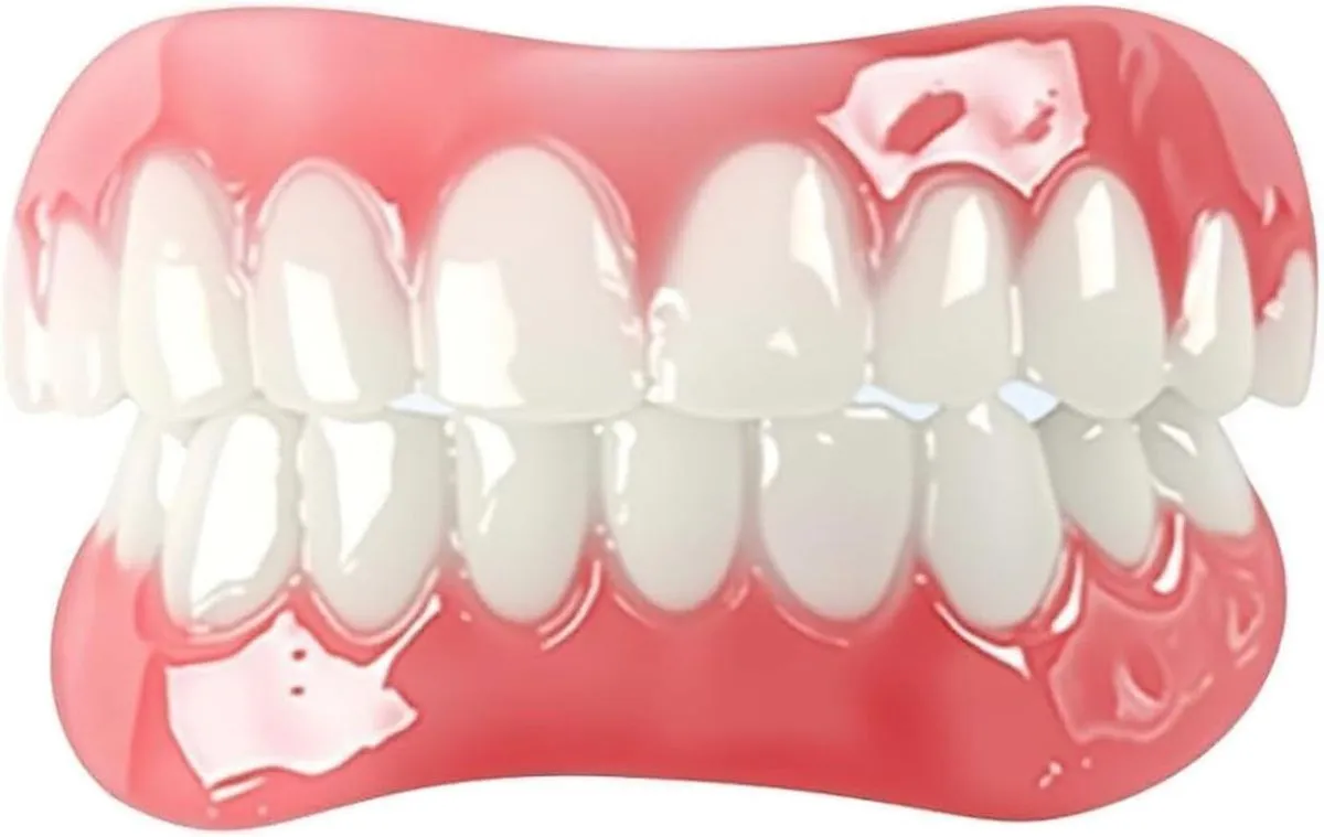 Adjustable Natural Smile Veneers Set