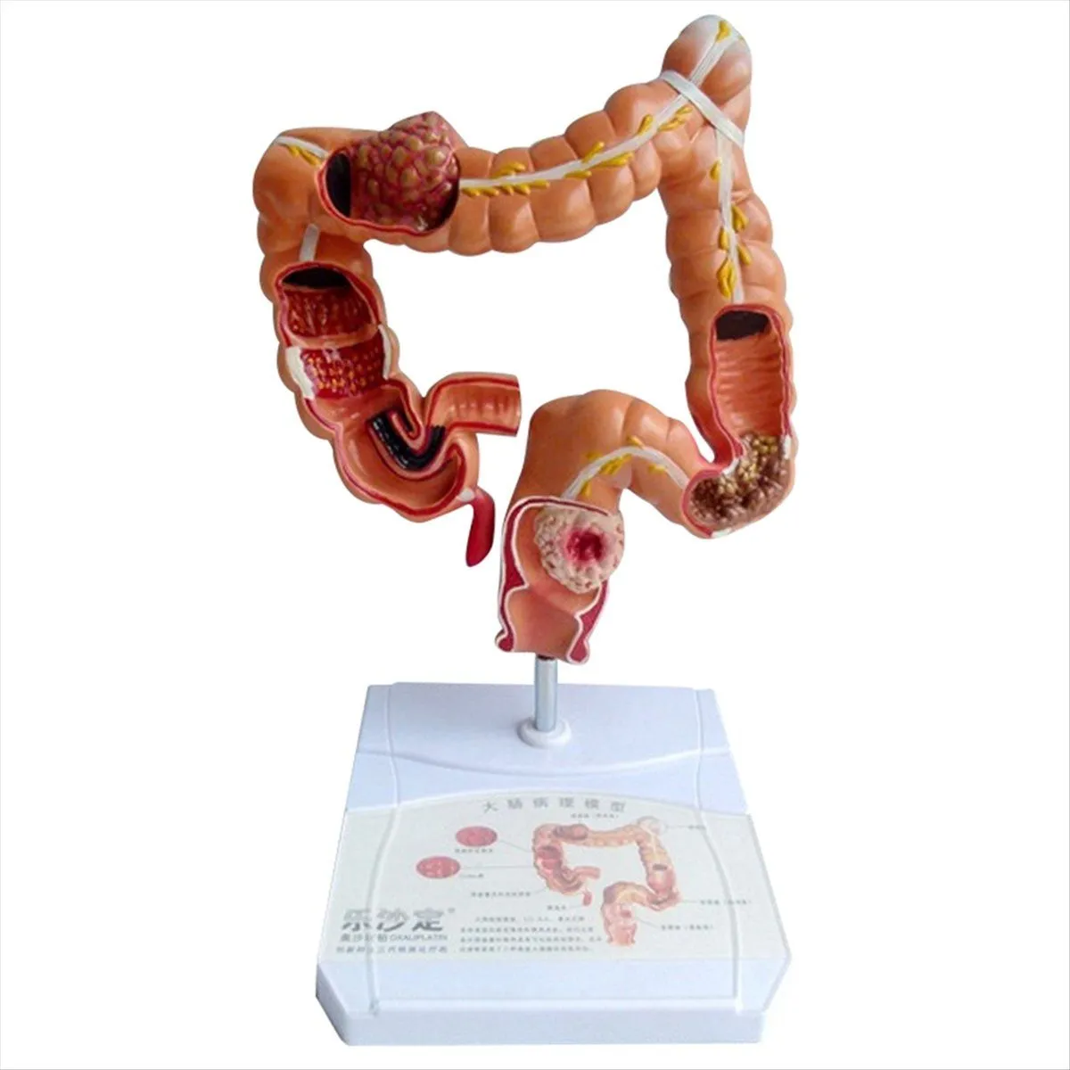 Teaching Model Human Intestine Anatomy Model Compatible with Universal