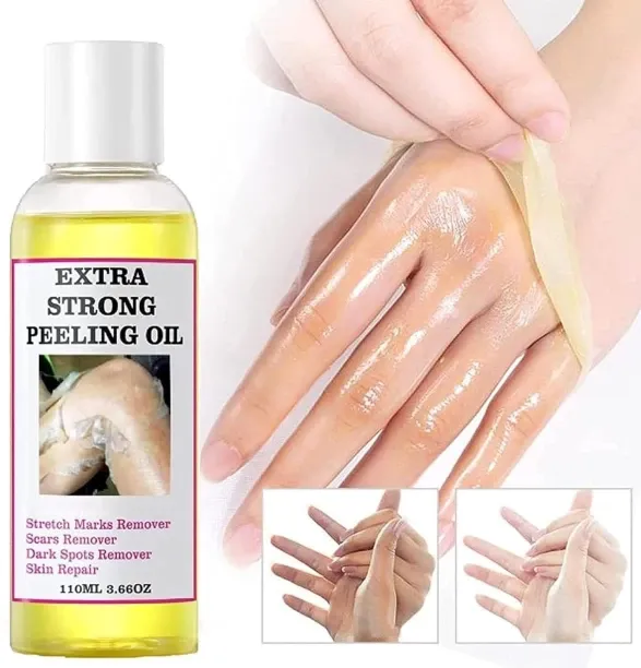 gaoshang Universal Extra Strength Yellow Exfoliating Oil for Dark Skin – Exfoliant for Body, Hands,…
